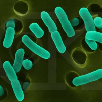 Discuţii la nivel european privind cazurile de contaminare cu E.coli. Ar putea fi declanşată o alertă în UE Discuţii la nivel european privind cazurile de contaminare cu E.coli. Ar putea fi declanşată o alertă în UE