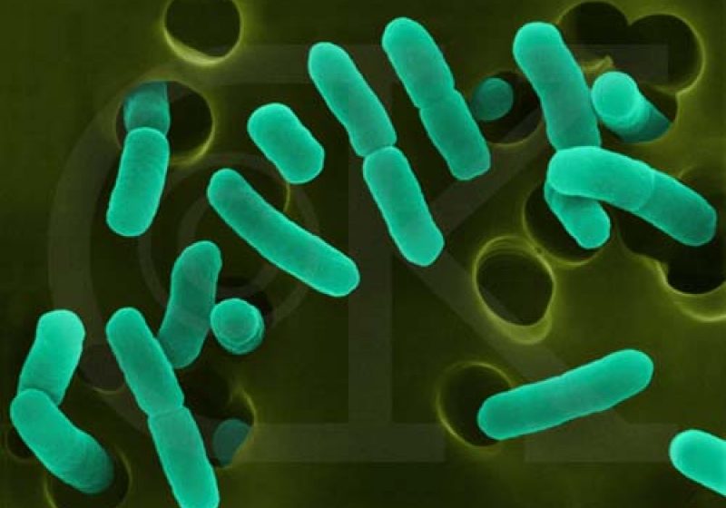 Discuţii la nivel european privind cazurile de contaminare cu E.coli. Ar putea fi declanşată o alertă în UE