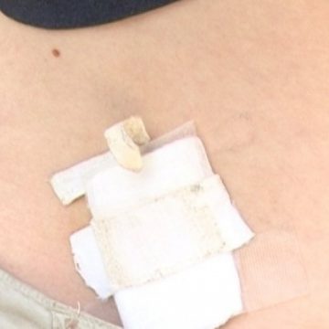 Incident neplacut la Scoala Generala din Nanesti petrecut intre doi colegi din clasa a III-a