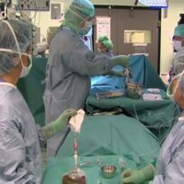 Mortalitatea bărbaţilor de cancer, mai ridicată decât a femeilor Mortalitatea bărbaţilor de cancer, mai ridicată decât a femeilor