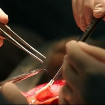 Suedia: Primul transplant al unui organ sintetic pentru un bolnav de cancer Suedia: Primul transplant al unui organ sintetic pentru un bolnav de cancer