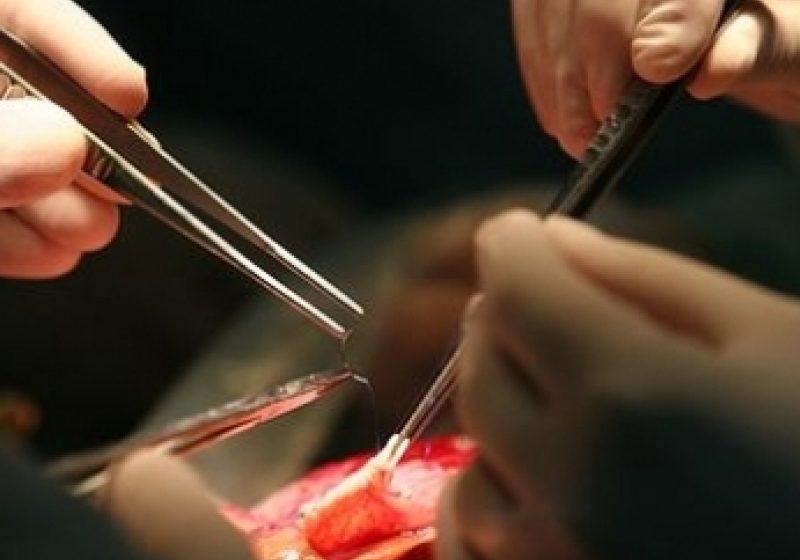 Suedia: Primul transplant al unui organ sintetic pentru un bolnav de cancer