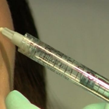 Femeile care apelează la botox, judecate aspru pentru intervenţii