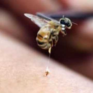 Elevi, victime ale înţepăturii de viespe