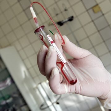 1000 de romani infectati cu virusul hepatitei C