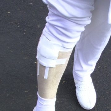 SIGHET Muşcată de un câine maidanez, lângă blocul în care locuieşte
