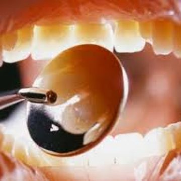Baia Mare: PENURIE DE MEDICI STOMATOLOGI LA SATE – Doar 19 medici stomatologi, în relaţie contractuală cu C.A.S., profesează în mediul rural Baia Mare: PENURIE DE MEDICI STOMATOLOGI LA SATE – Doar 19 medici stomatologi, în relaţie contractuală cu C.A.S., profesează în mediul rural