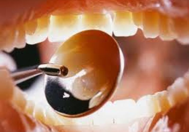 Baia Mare: PENURIE DE MEDICI STOMATOLOGI LA SATE – Doar 19 medici stomatologi, în relaţie contractuală cu C.A.S., profesează în mediul rural