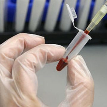 În viitor infarctul ar putea fi prevăzut cu ajutorul unui test de sânge În viitor infarctul ar putea fi prevăzut cu ajutorul unui test de sânge