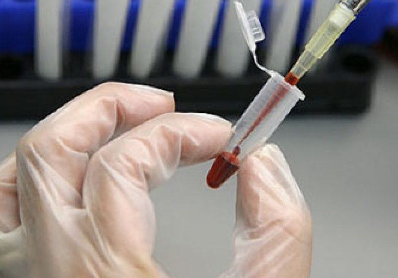 În viitor infarctul ar putea fi prevăzut cu ajutorul unui test de sânge
