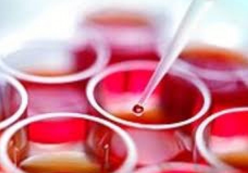 Reprezentanţi ai unei clinici private din Capitală, suspectaţi de trafic de celule de origine umană Reprezentanţi ai unei clinici private din Capitală, suspectaţi de trafic de celule de origine umană