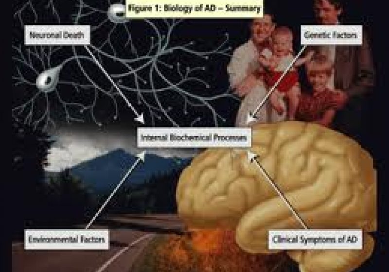 Demenţa este mai costisitoare pentru societatea americană decât cancerul sau bolile cardiace (studiu)