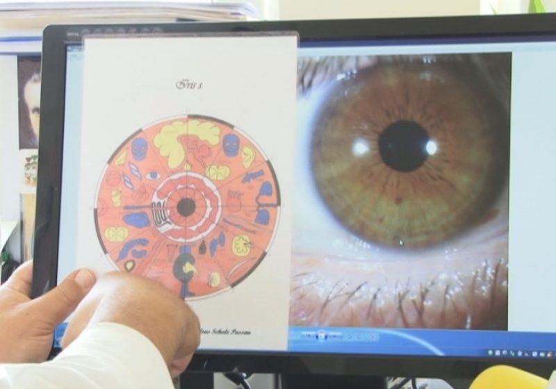 SIGHET:La Sighet s-a deschis recent un cabinet de iridologie, Irisul ne poate dezvălui bolile de care suferim sau vom suferi SIGHET:La Sighet s-a deschis recent un cabinet de iridologie, Irisul ne poate dezvălui bolile de care suferim sau vom suferi