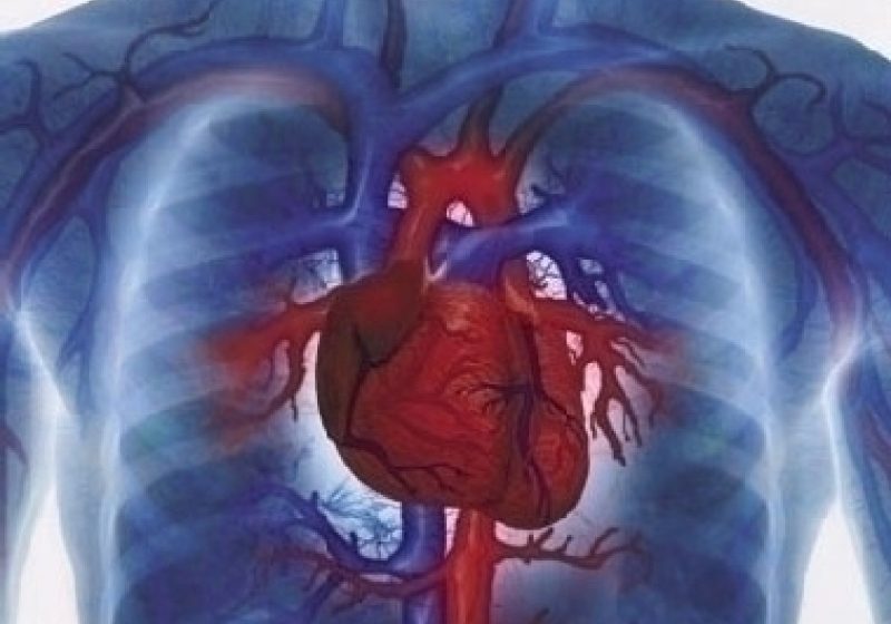 Bolile cardiovasculare sunt principala cauză de deces
