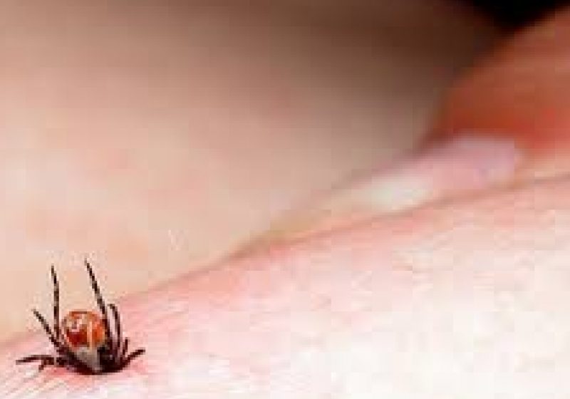 SIGHET: Aproximativ 5  pacienţi muşcaţi de căpuşe vin zilnic la urgenţe. Ce recomandări fac medicii