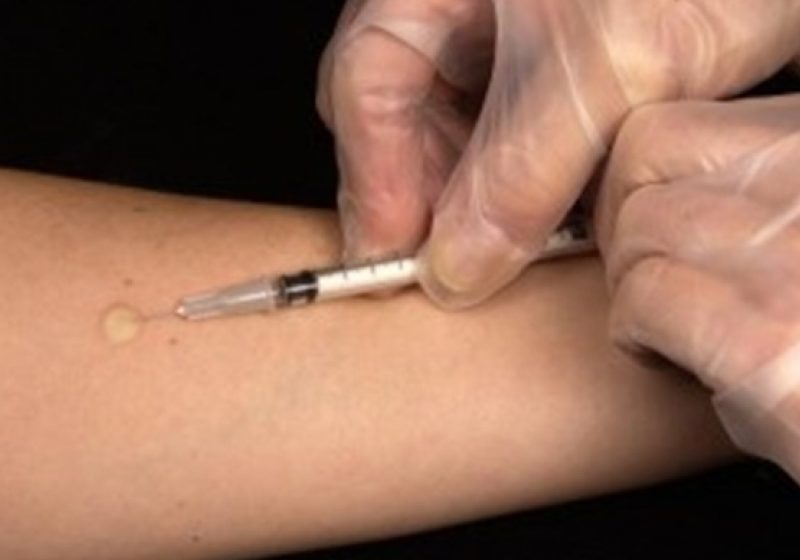 Un test sangvin creat de un cercetător român ar putea prezice riscul de sinucidere