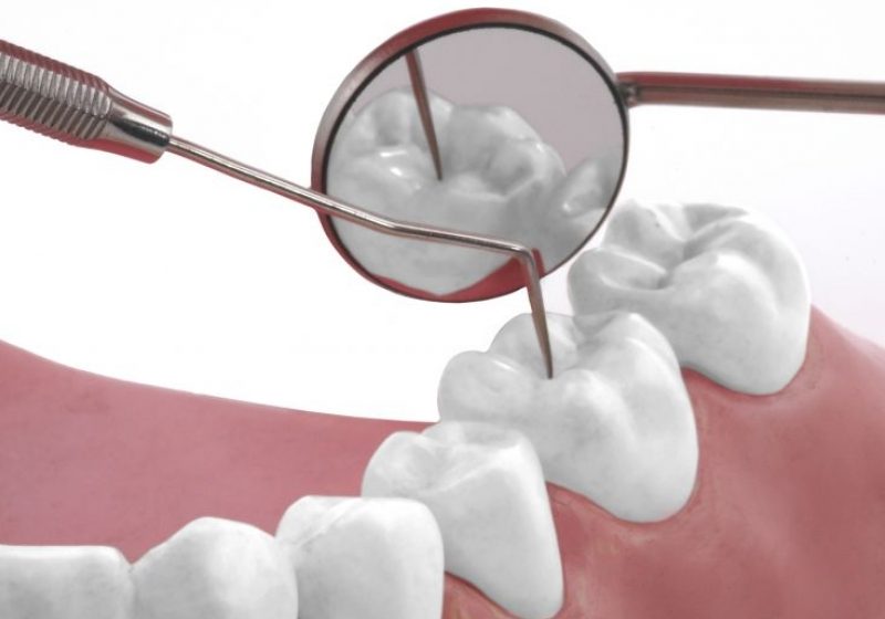 Aproximativ 10.000 de copii instituţionalizaţi au beneficiat de asistenţă stomatologică gratuită