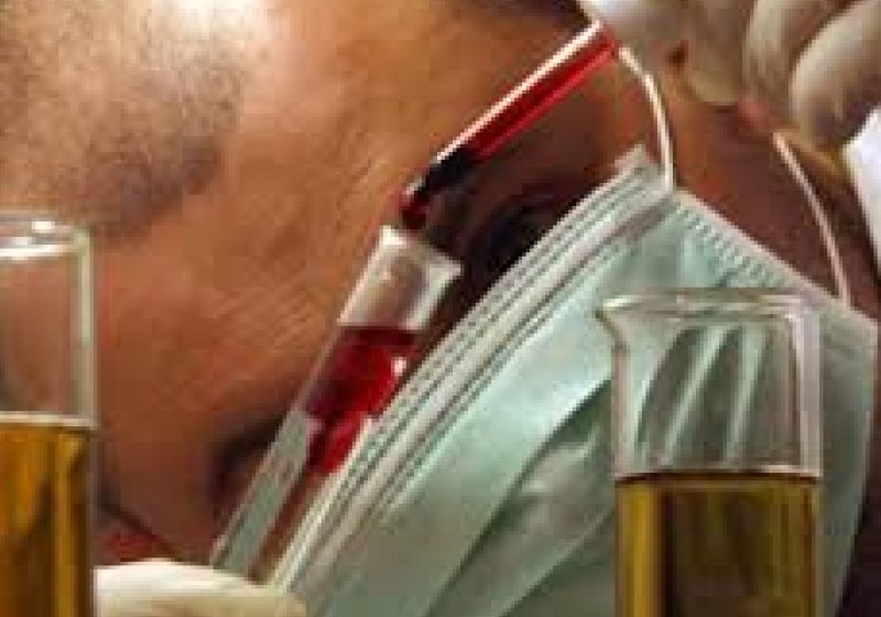 DESCOPERIRE: Analiză de sânge pentru detectarea cancerului pancreatic în stare incipientă