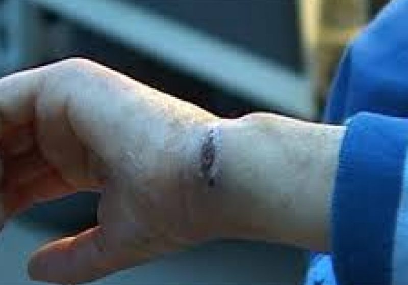 STUDIU: Copiii bătuţi de părinţi obţin rezultate mai slabe la testele lingvistice