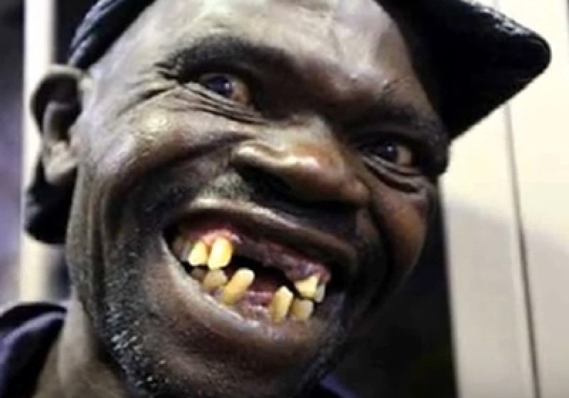CEL MAI URÂT BĂRBAT DIN ZIMBABWE: Câştigătorul, contestat pe motiv că "ar fi prea frumos" CEL MAI URÂT BĂRBAT DIN ZIMBABWE: Câştigătorul, contestat pe motiv că "ar fi prea frumos"