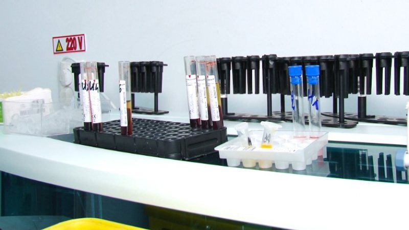 SFATUL SPECIALIȘTILOR: Când trebuie făcute unele analize SFATUL SPECIALIȘTILOR: Când trebuie făcute unele analize