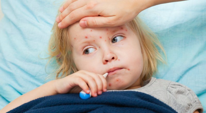 EPIDEMIE: Încă un copil a murit din cauza rujeolei EPIDEMIE: Încă un copil a murit din cauza rujeolei