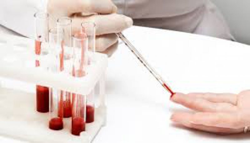 INOVAȚIE: Un nou test de sânge poate depista tuberculoza în doar câteva ore INOVAȚIE: Un nou test de sânge poate depista tuberculoza în doar câteva ore
