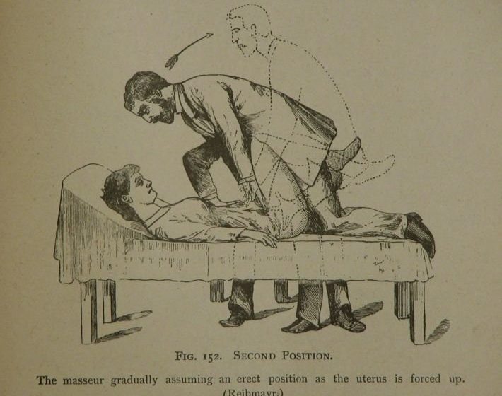 DESCOPERĂ: Istoria stranie a vibratorului. Vezi pentru ce era utilizat