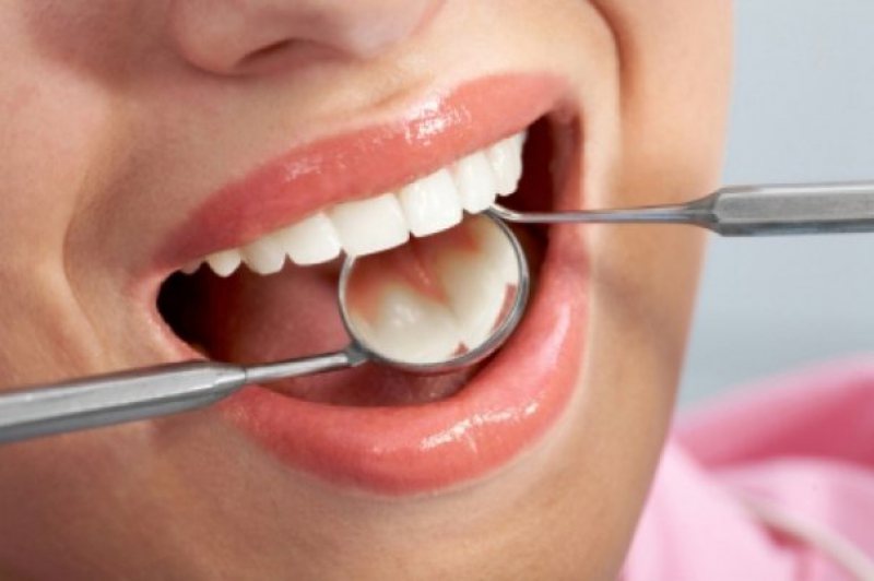 SĂNĂTATE:Peste 500 de români au fost diagnosticaţi, anul trecut, cu cancer oral SĂNĂTATE:Peste 500 de români au fost diagnosticaţi, anul trecut, cu cancer oral