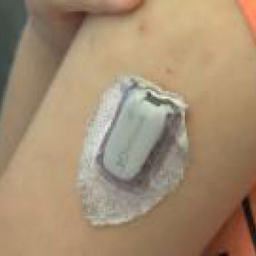 SPECIALIȘTI: 4.500 de înţepături în fiecare an – atâtea suportă un copil cu diabet tip 1 SPECIALIȘTI: 4.500 de înţepături în fiecare an – atâtea suportă un copil cu diabet tip 1