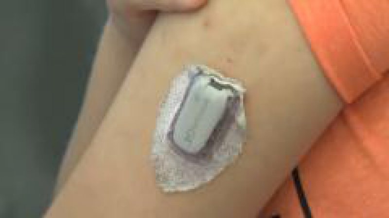 SPECIALIȘTI: 4.500 de înţepături în fiecare an – atâtea suportă un copil cu diabet tip 1 SPECIALIȘTI: 4.500 de înţepături în fiecare an – atâtea suportă un copil cu diabet tip 1