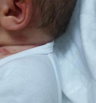 ANCHETĂ EPIDEMIOLOGICĂ LA SPITALUL JUDEȚEAN: Doi nou-născuţi infectaţi cu stafilococ ANCHETĂ EPIDEMIOLOGICĂ LA SPITALUL JUDEȚEAN: Doi nou-născuţi infectaţi cu stafilococ