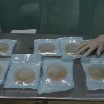 ÎNGRIJORĂTOR: Ministrul Sănătăţii, despre închiderea singurei bănci de piele din ţară: Nu mai putea funcţiona în siguranţă ÎNGRIJORĂTOR: Ministrul Sănătăţii, despre închiderea singurei bănci de piele din ţară: Nu mai putea funcţiona în siguranţă
