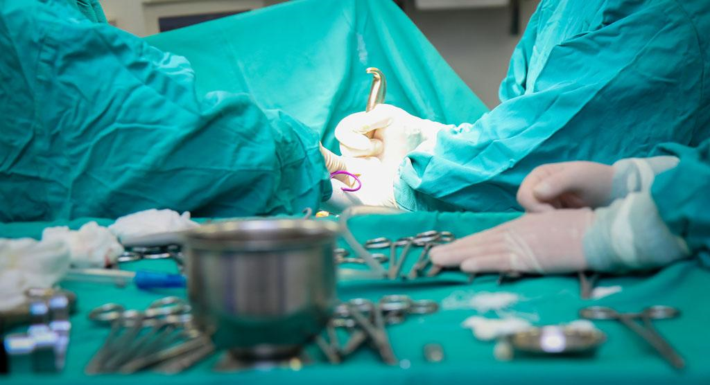 Tumoră uriașă operată cu succes la Spitalul Județean