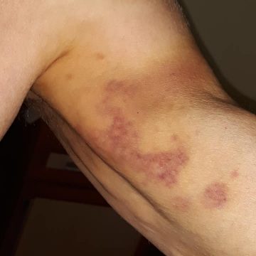 Cercetări la Spitalul Municipal Sighetu Marmației după ce un bătrân ar fi fost bătut