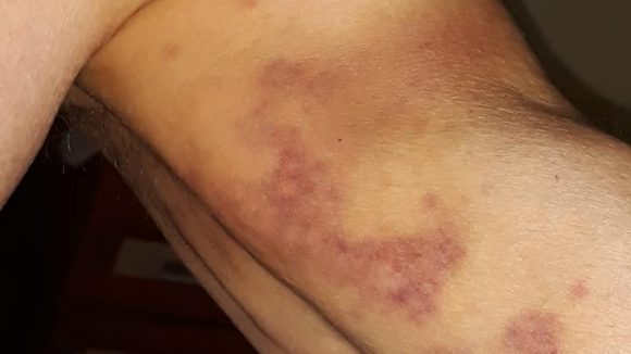 Cercetări la Spitalul Municipal Sighetu Marmației după ce un bătrân ar fi fost bătut