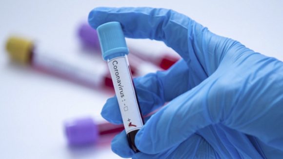 344 de noi cazuri de infecție cu coronavirus înregistrate în ultimele 24 de ore 344 de noi cazuri de infecție cu coronavirus înregistrate în ultimele 24 de ore