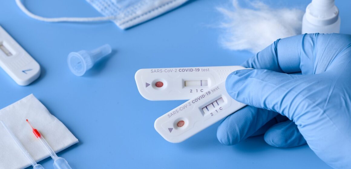 Teste COVID-19 pentru acasă. Preţurile variază între 50 și 138 de lei, iar procedura este similară cu cea de la testele pentru glicemie sau pentru sarcină