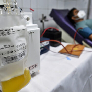 Apel către persoanele vindecate de SARS CoV-2 pentru a se implica în donarea de plasmă convalescentă Apel către persoanele vindecate de SARS CoV-2 pentru a se implica în donarea de plasmă convalescentă
