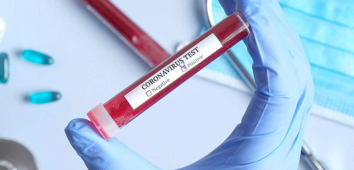 VIDEO | CORONAVIRUS: 172 de cazuri noi în județul Maamureș VIDEO | CORONAVIRUS: 172 de cazuri noi în județul Maamureș